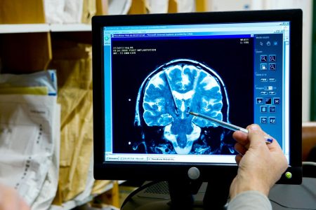 The Brain Technology for Neurology That Will Benefit From AI