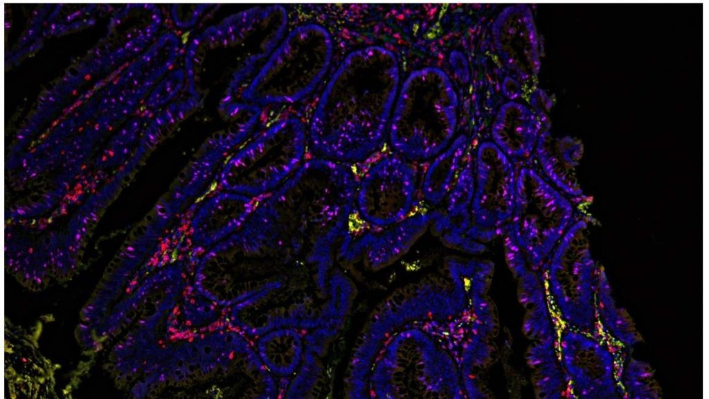 26M New Cases, Three Dimensions, One Technology: Bioprinting & Cancer