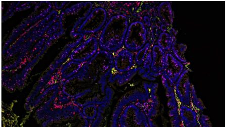 26M New Cases, Three Dimensions, One Technology: Bioprinting & Cancer