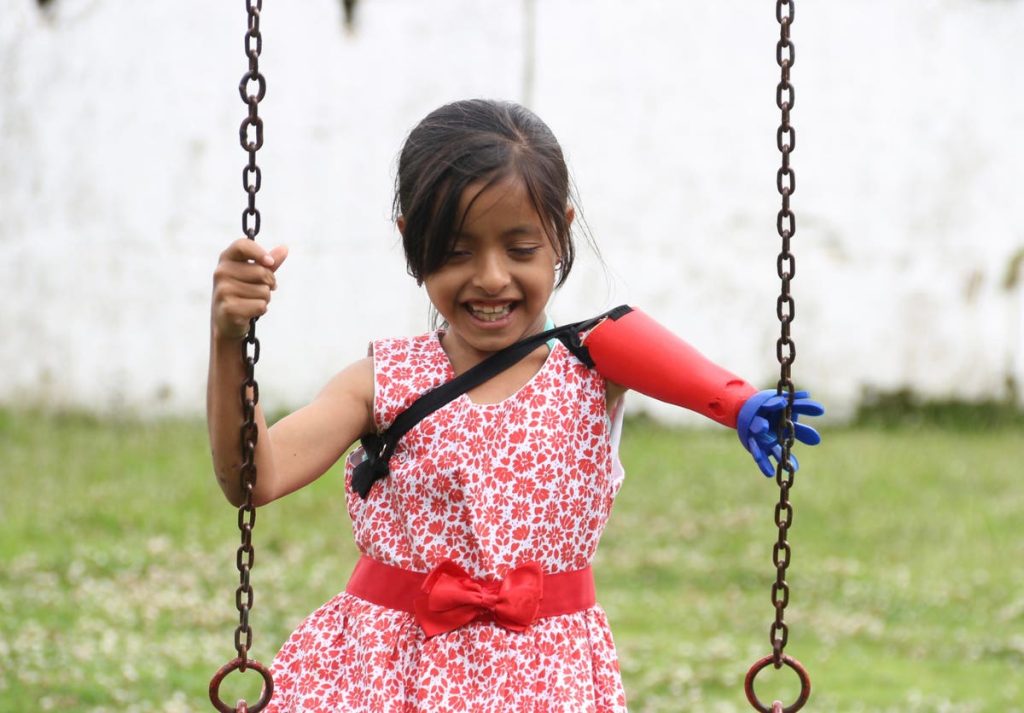 For Children Who Need Prosthetics, A New Design Process Puts Them In Charge