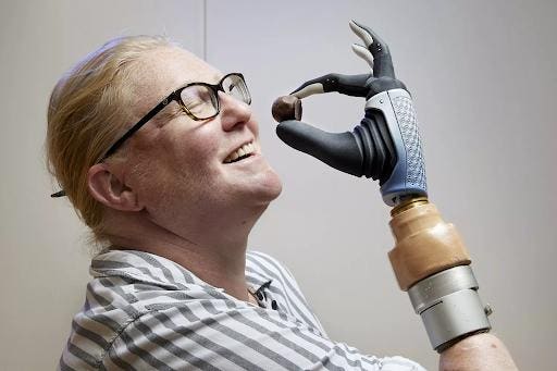 The Future Of Bioelectronic Prosthetics