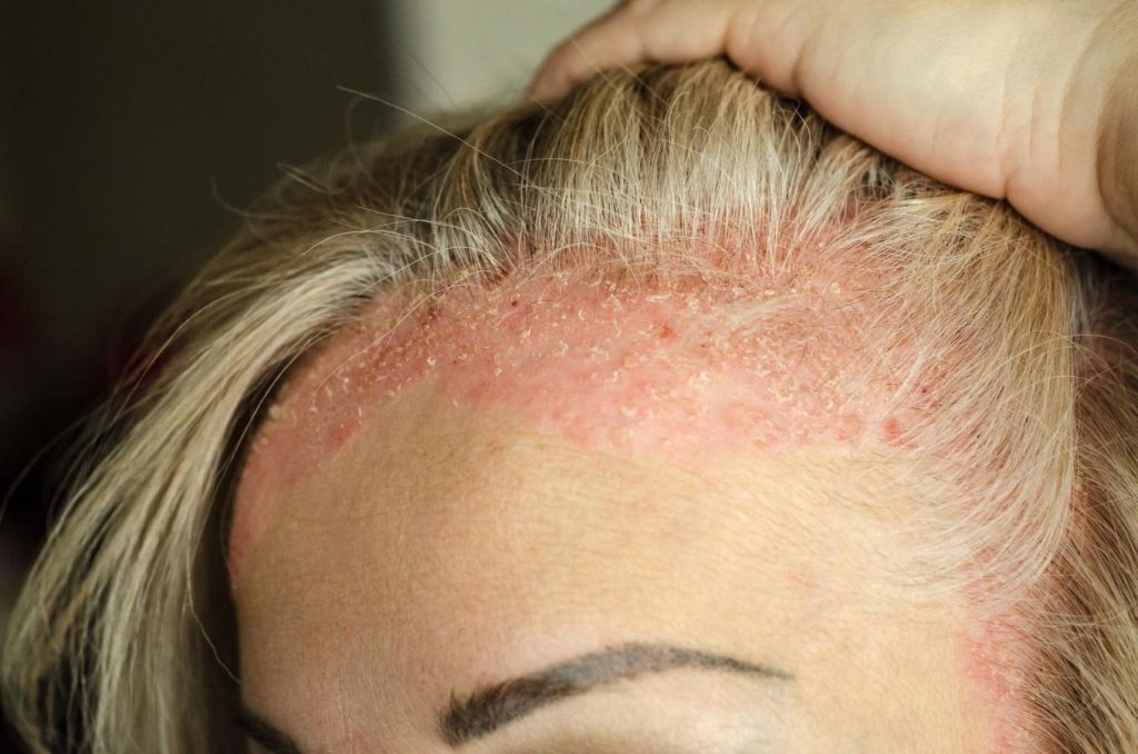 How Gut Health Affects Your Skin Health — Experts Explain
